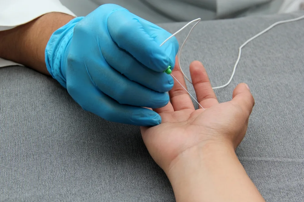 emg testing on the hand