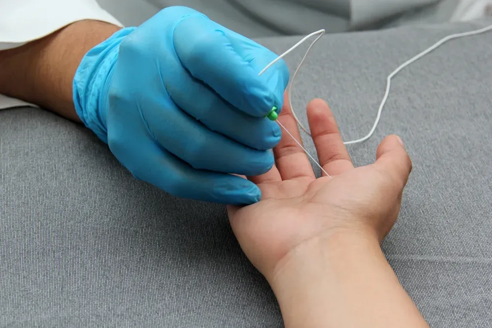 EMG testing on the hand