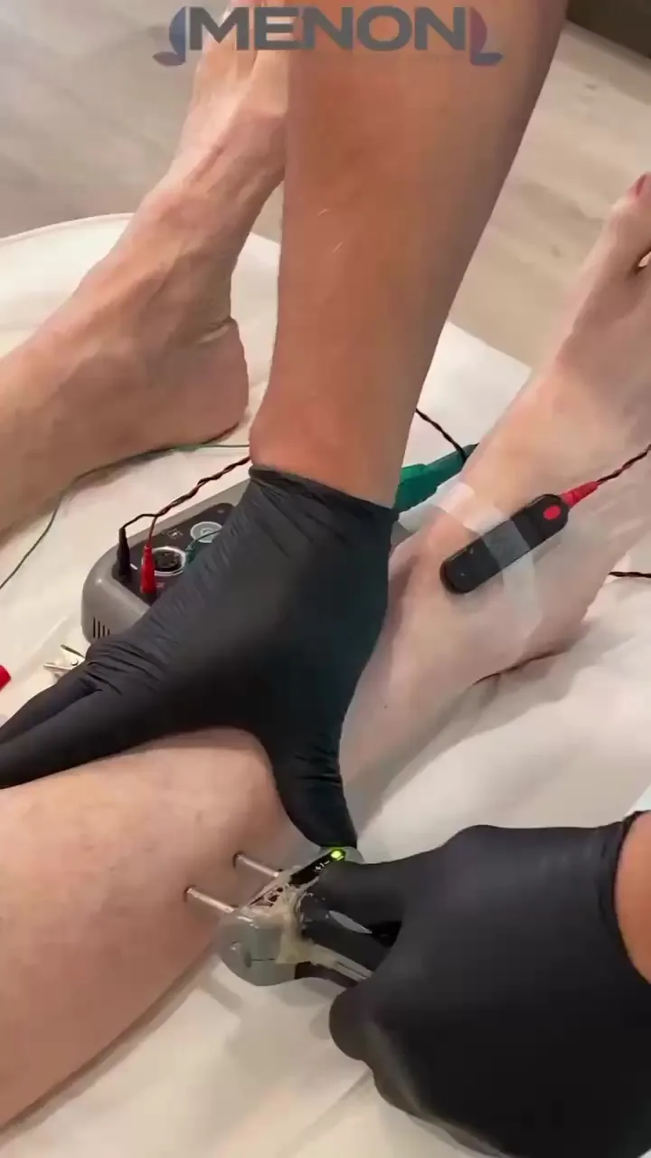 Dr. Menon performing EMG testing in the Millburn office
