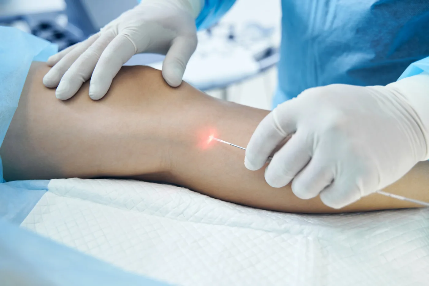 Patient getting endovenous laser ablation therapy in Millburn NJ