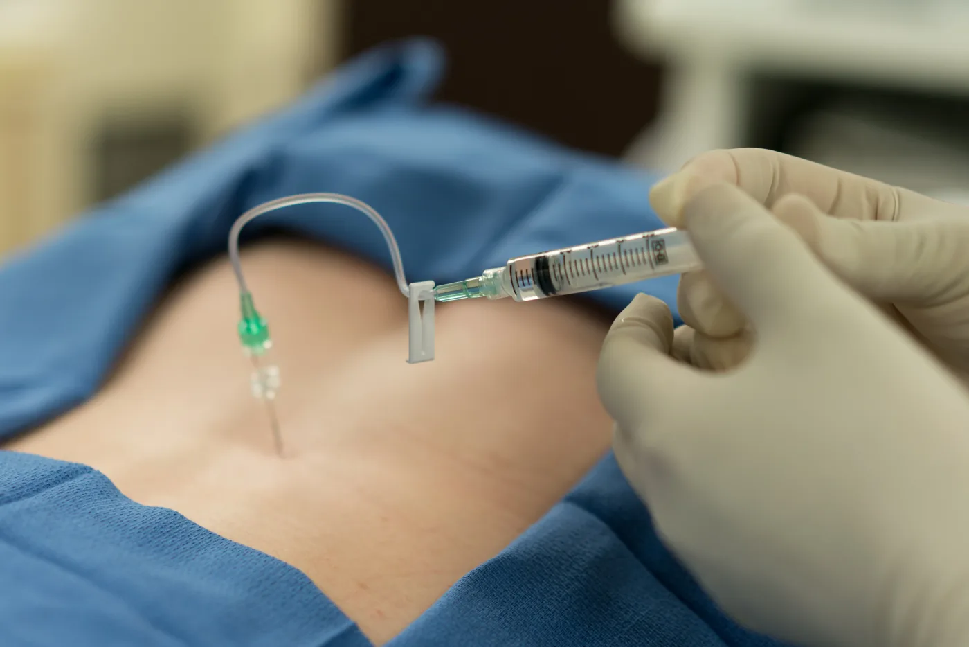 Patient getting an epidural injection in Millburn NJ