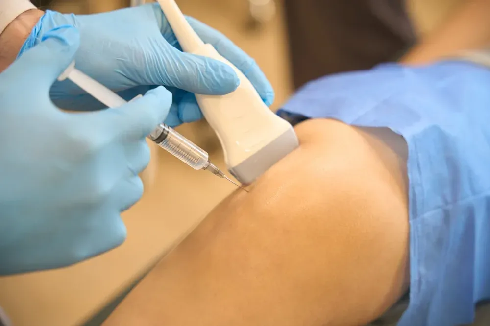 Knee gel injection procedure for arthritis pain relief