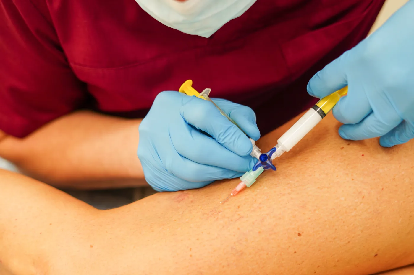 Patient getting sclerotherapy for varicose veins in Millburn NJ