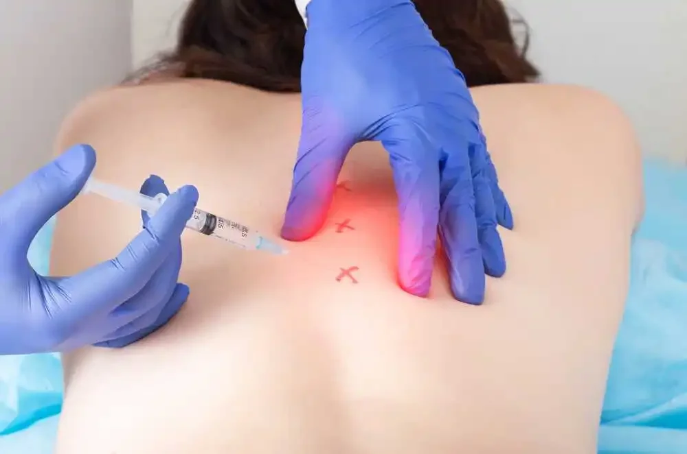 Patient getting trigger point injections in Millburn NJ