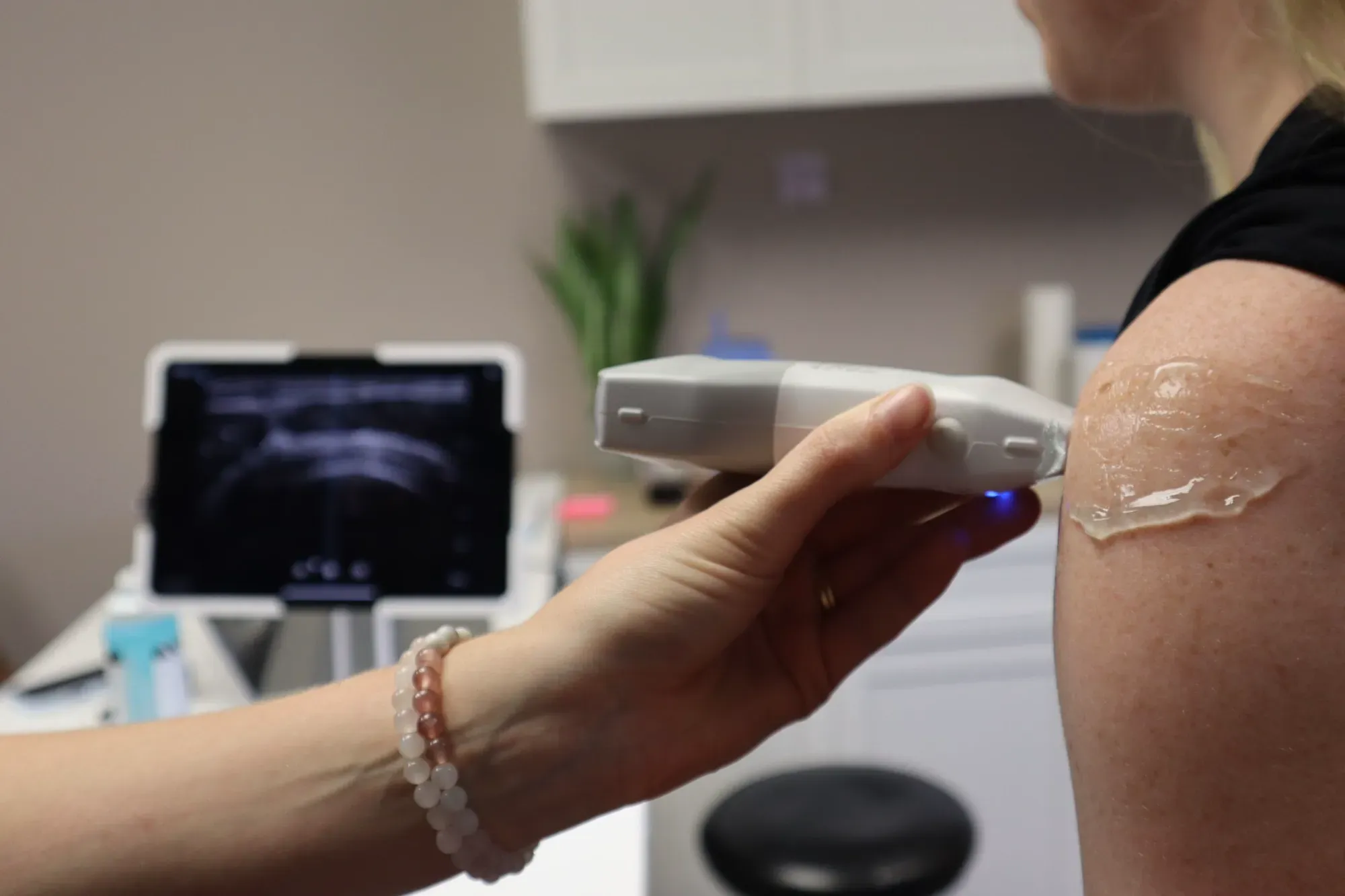 Clinician scanning a patient's shoulder with a handheld ultrasound probe, the live image on a screen behind