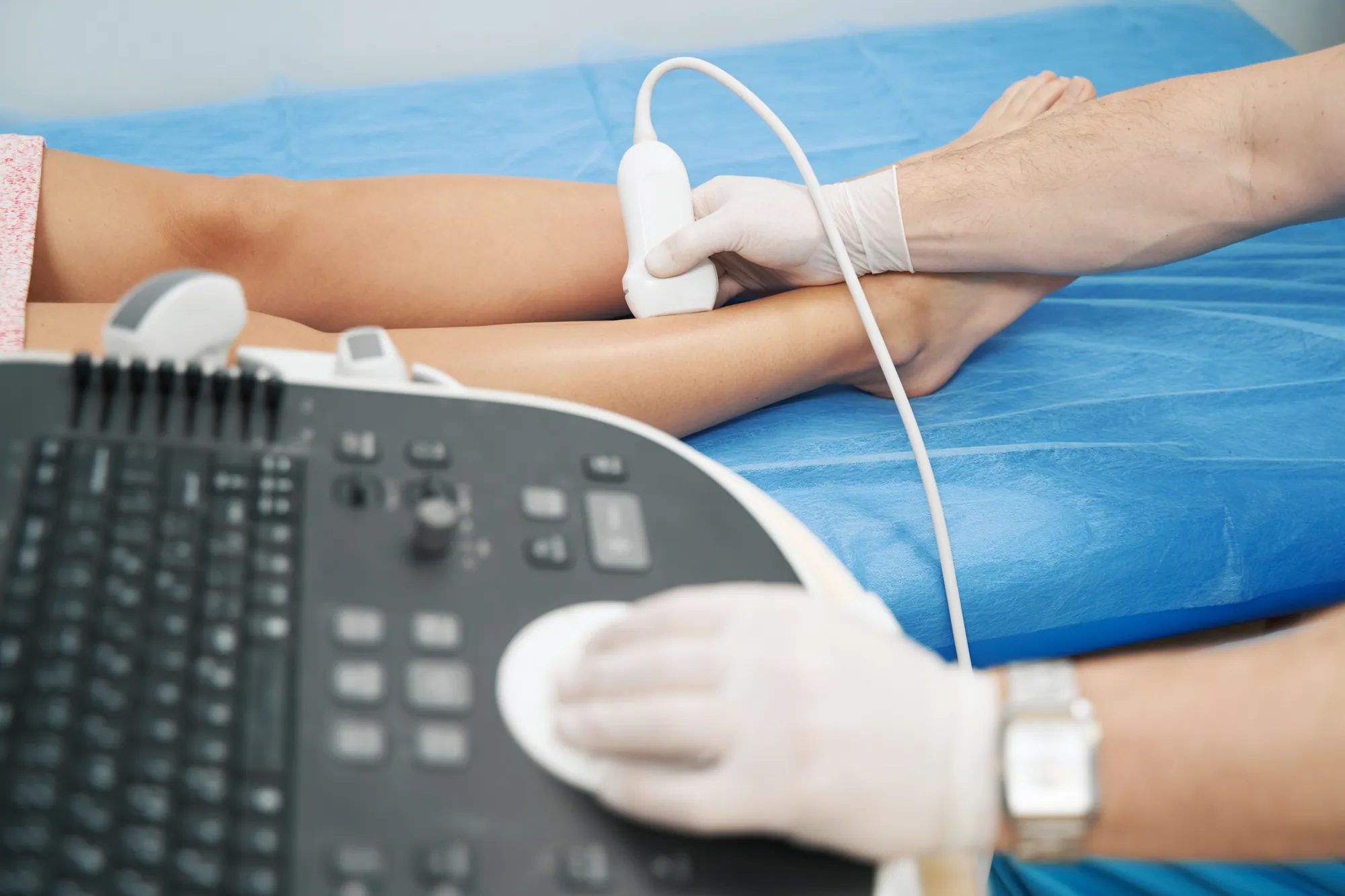 Clinician performing a Doppler ultrasound on a patient's lower leg